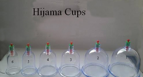 Hijjama Cups Set