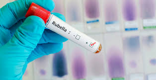 Rubella vaccine