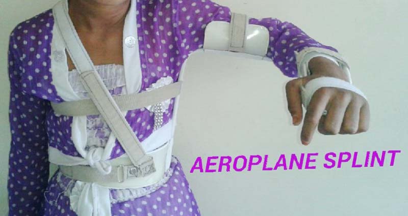 Aeroplane Splint