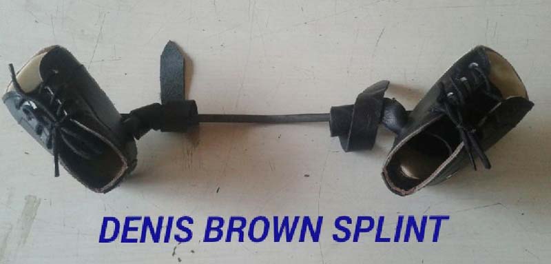 Denis Brown Splint, Features : Long functional life