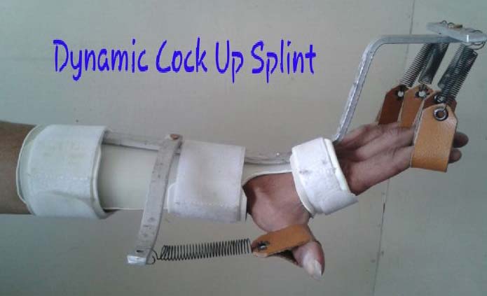 Dynamic Cock Up Splint, Color : White