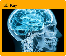 X Ray Machine