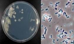 Azotobacter Bacteria