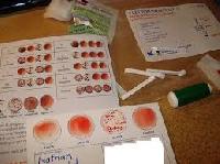 Blood Group Test Kit, for Clinical, Feature : Active