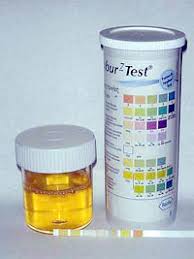 Urine rim Test