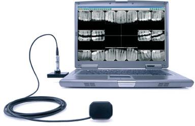 Dental  Digital X- rays