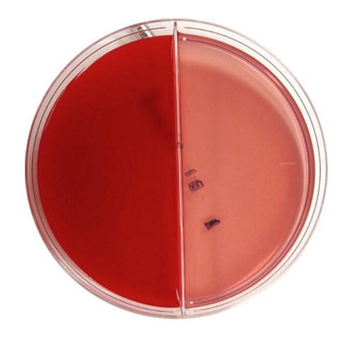 Bi Blood and Macconkey Agar Plate