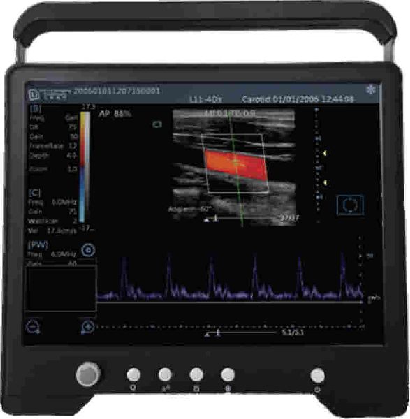 ColourDoppler Ultrasound Scanner