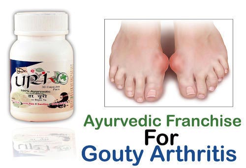 Ayurvedic Franchise For Gouty Arthritis