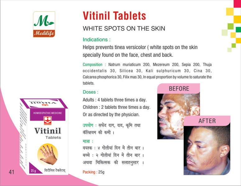 Vitinil Tablets