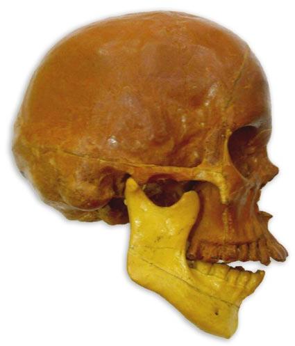 Artificial Skull