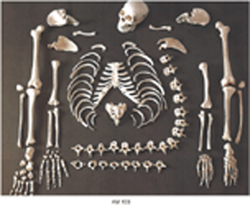 Disarticulated Human Skeleton