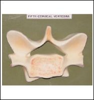 Fifth Cervical Vertebra