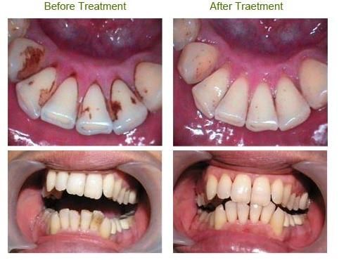 Scaling Dental Services