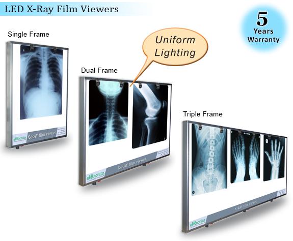 Led X Ray Film Viewer