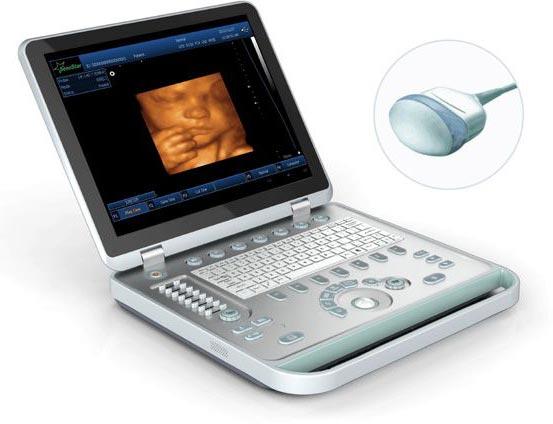 4D Laptop Ultrasound Scanner