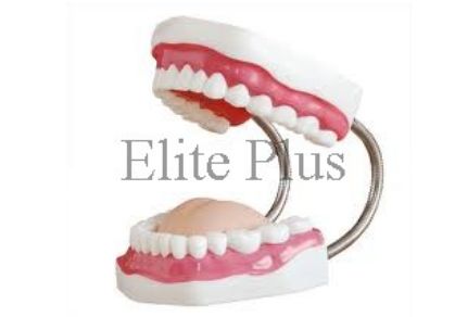 Dental implant Model