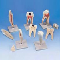 Classic Tooth Model