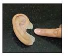 Ear Prosthesis Fitting