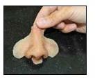 Nose Prosthesis