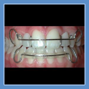 Dental Hawley Retainer