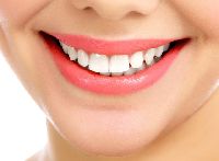 Smile Makeover Treatment Services