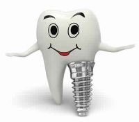 Implant Dentistry