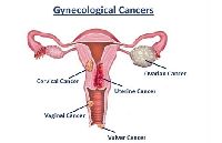 Gynaecological Cancer