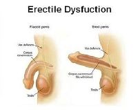 Erectile Dysfunction Treatment Services