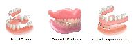Denture Treatment Services