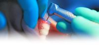 Laser Dentistry Treatment Services