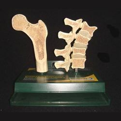 Osteoporosis Models