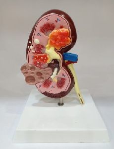 Kidney Pathological Model