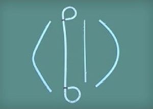 Biliary Stent