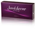 Juvederm Ultra Injections