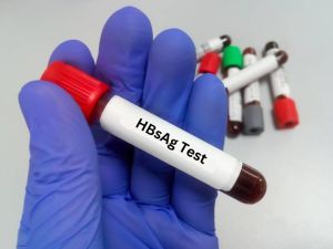 Hepa Scan Hbsag Test Kit