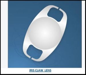 Iris Claw Lens