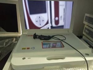 Laparoscopy Camera