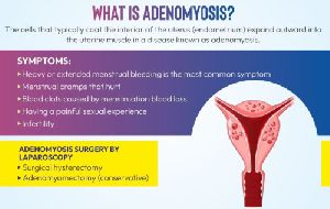 uterine adenomyosis services