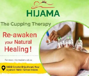 Cupping Therapy Services