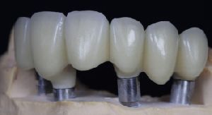 zirconia dental crown
