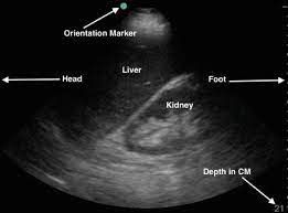 general abdominal ultrasound service