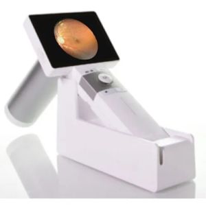 Digital Fundus Camera