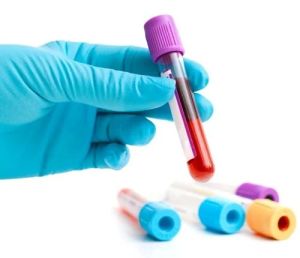 Blood Test Services