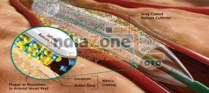 Drug Eluting Balloon