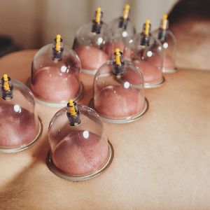 Cupping Therapy in Patiala