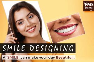 Cosmetic Smile Designing
