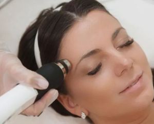 Advanced Laser Hair Removal Treatment For Face