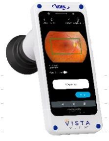 Vista View™ Mydriatic Portable Fundus Camera