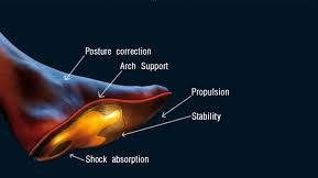 Custom Orthopedic Insole